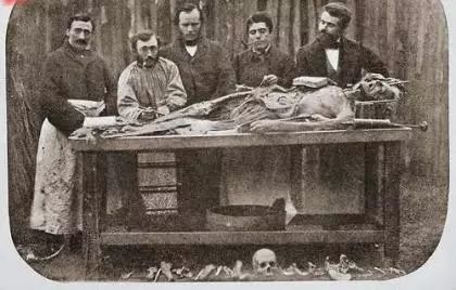 恐怖！100年前解剖人體的圖片，看著很詭異！ 靈異 第12張