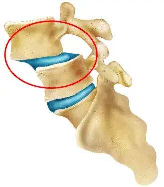 【博野明德医院】什么是脊椎滑脱?-医院动态-博野明德医院