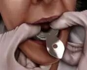 牙科材料硅胶怎么用硅橡胶临床操作指南_https://www.jmylbn.com_新闻资讯_第10张