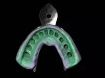 牙科材料硅胶怎么用硅橡胶临床操作指南_https://www.jmylbn.com_新闻资讯_第11张