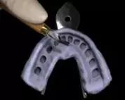 牙科材料硅胶怎么用硅橡胶临床操作指南_https://www.jmylbn.com_新闻资讯_第14张