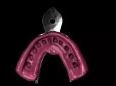 牙科材料硅胶怎么用硅橡胶临床操作指南_https://www.jmylbn.com_新闻资讯_第6张