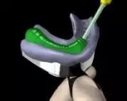 牙科材料硅胶怎么用硅橡胶临床操作指南_https://www.jmylbn.com_新闻资讯_第15张