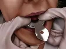 牙科材料硅胶怎么用硅橡胶临床操作指南_https://www.jmylbn.com_新闻资讯_第5张