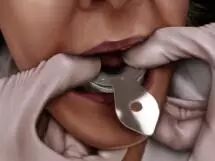 牙科材料硅胶怎么用硅橡胶临床操作指南_https://www.jmylbn.com_新闻资讯_第13张