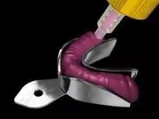 牙科材料硅胶怎么用硅橡胶临床操作指南_https://www.jmylbn.com_新闻资讯_第3张