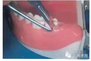 牙周翻瓣术操作全图解