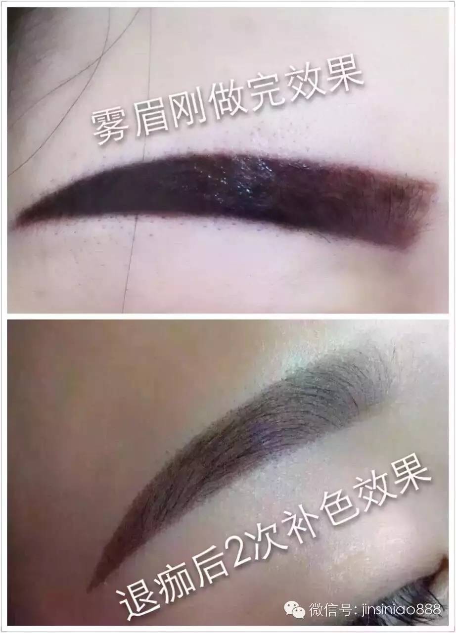 纹眉反色期图片