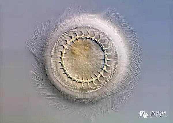 显微镜下的车轮虫