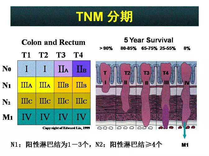 专家讲座从肠计议早预防牵肠挂肚话肠癌