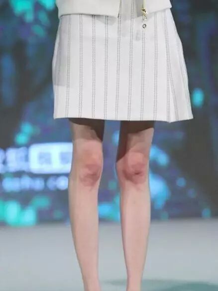 郑爽又瘦了?再高的颜值也没有"竹竿腿"来的抢镜!