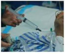 为什么使用密闭式吸痰管【技能操作】密闭式经气管插管吸痰法(附视频)_https://www.jmylbn.com_新闻资讯_第5张