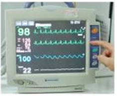 为什么使用密闭式吸痰管【技能操作】密闭式经气管插管吸痰法(附视频)_https://www.jmylbn.com_新闻资讯_第2张