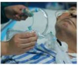 为什么使用密闭式吸痰管【技能操作】密闭式经气管插管吸痰法(附视频)_https://www.jmylbn.com_新闻资讯_第4张