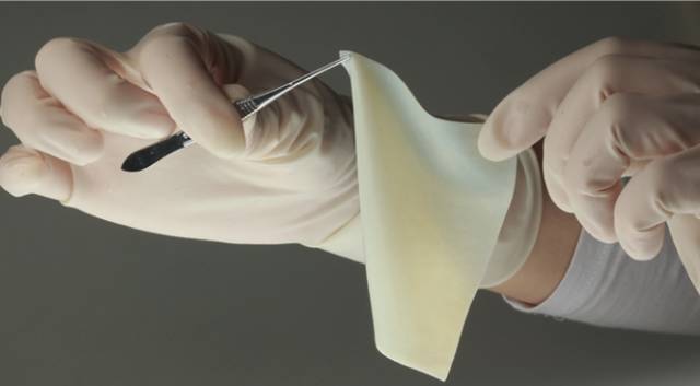 医疗器械用什么材料可吸收高分子材料在植入医疗器械中的应用及研发方向_https://www.jmylbn.com_新闻资讯_第9张