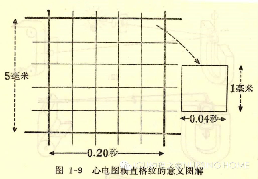 (1) 關於心電圖紙的說明2 典型心電圖的測量圖1 正常心電圖(6)q—t間