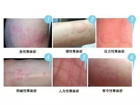 天啊花露水竟然会引发自燃不可思议的危害你以后还敢这么做吗