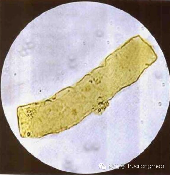 尿液检验常见尿沉渣图谱
