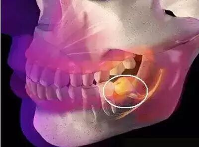 你为什么总塞牙