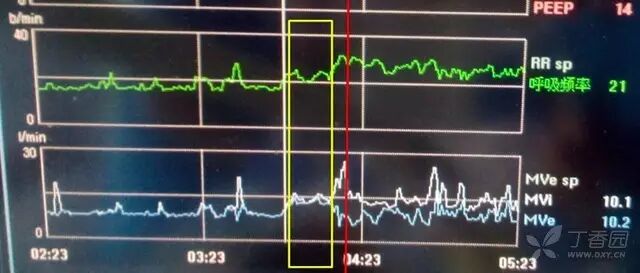 呼吸机常见报警有哪些盘点各类呼吸机报警，总结篇_https://www.jmylbn.com_新闻资讯_第3张