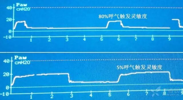 呼吸机是怎么给压力的呼吸机菜鸟上手指南：机械通气参数设置不再傻傻搞不清_https://www.jmylbn.com_新闻资讯_第4张