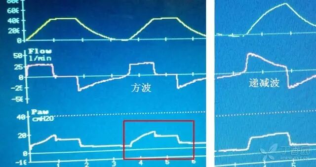 呼吸机是怎么给压力的呼吸机菜鸟上手指南：机械通气参数设置不再傻傻搞不清_https://www.jmylbn.com_新闻资讯_第2张