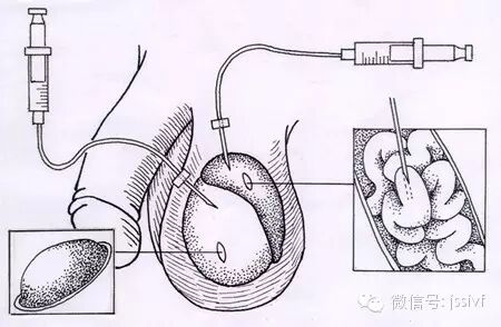 取精器怎么取精取精指南！帮你取到最优秀的精子！_https://www.jmylbn.com_新闻资讯_第4张