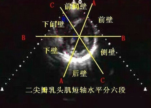 左心室分段的依据方法与记忆技巧