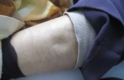 身体好不好?看腿就知道