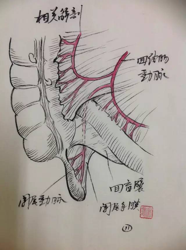 阑尾切除术手术步骤图图片