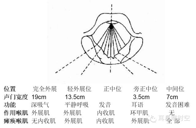 声带瘫痪下的各种位置声带麻痹与功能性失音鉴别:声带麻痹多为一侧性