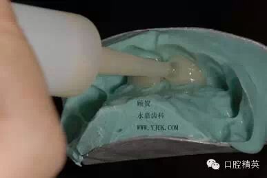 dmg口腔材料怎么使用不要小看临时牙_https://www.jmylbn.com_新闻资讯_第10张