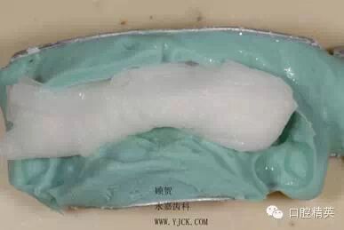 dmg口腔材料怎么使用不要小看临时牙_https://www.jmylbn.com_新闻资讯_第8张