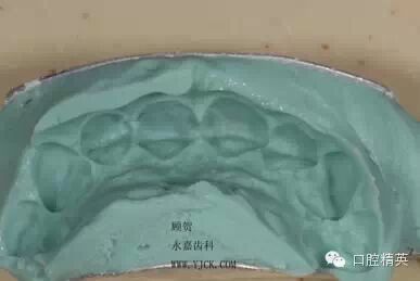 dmg口腔材料怎么使用不要小看临时牙_https://www.jmylbn.com_新闻资讯_第7张