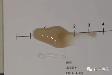 dmg口腔材料怎么使用不要小看临时牙_https://www.jmylbn.com_新闻资讯_第9张