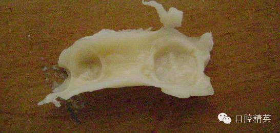 dmg口腔材料怎么使用不要小看临时牙_https://www.jmylbn.com_新闻资讯_第4张