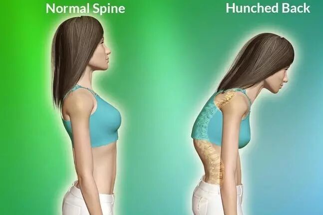 只要1分钟打开肩胛骨改善驼背肩痛最有效