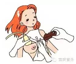 穿刺枪怎么升级乳腺穿刺术（二）_https://www.jmylbn.com_新闻资讯_第11张