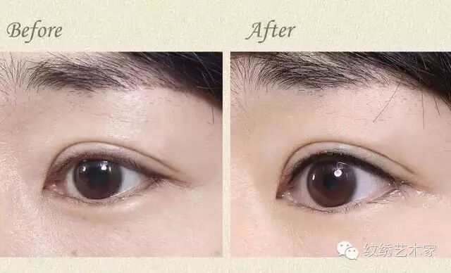 做美瞳线前后对比