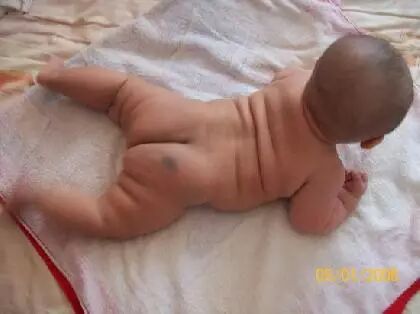 小胎记大玄机，关乎吉凶祸福！