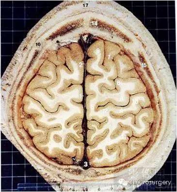 解剖| 經典顱腦斷層解剖圖——橫斷面_醫學界-助力醫生臨床決策和職業