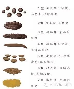 原来这才是无懈可击的便便!快对照一下,你的便便正常吗?