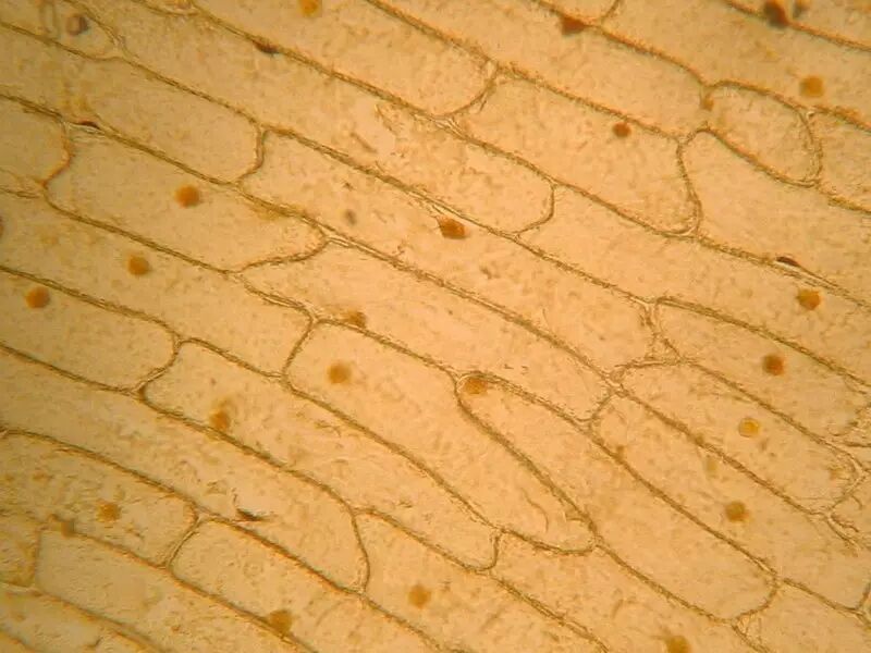 洋葱上皮细胞,观察植物细胞质壁分离的优秀材料.图片:microscopy-uk.