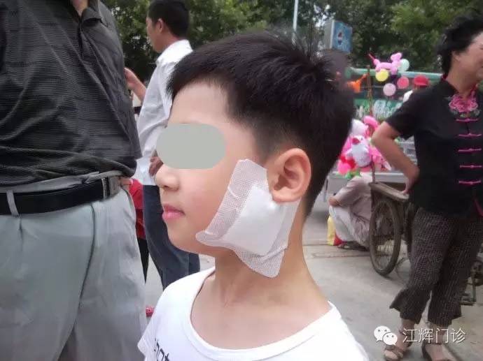 适用于痄腮引起的耳下腮部漫肿疼痛症状.