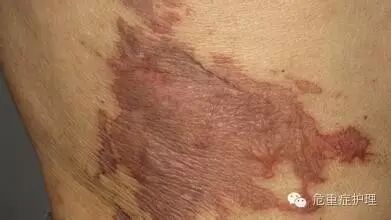 为什么选择双相波同步电复律？到底怎么回事？心电监护演示同步电复律全过程！_https://www.jmylbn.com_新闻资讯_第8张