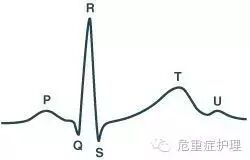 为什么选择双相波同步电复律？到底怎么回事？心电监护演示同步电复律全过程！_https://www.jmylbn.com_新闻资讯_第4张