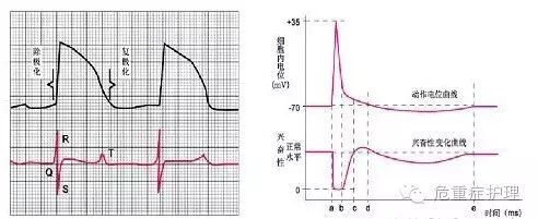 为什么选择双相波同步电复律？到底怎么回事？心电监护演示同步电复律全过程！_https://www.jmylbn.com_新闻资讯_第7张