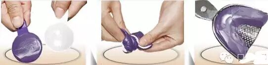 牙科材料硅胶怎么用硅橡胶取模操作详解_https://www.jmylbn.com_新闻资讯_第5张