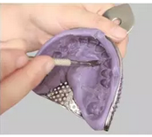 牙科材料硅胶怎么用硅橡胶取模操作详解_https://www.jmylbn.com_新闻资讯_第7张