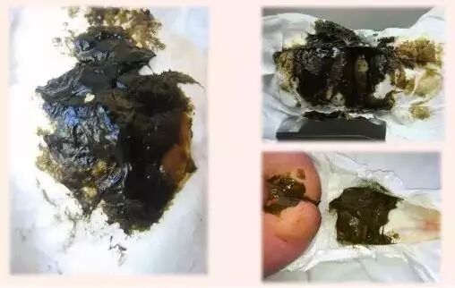 天啦噜!粑粑会说话?